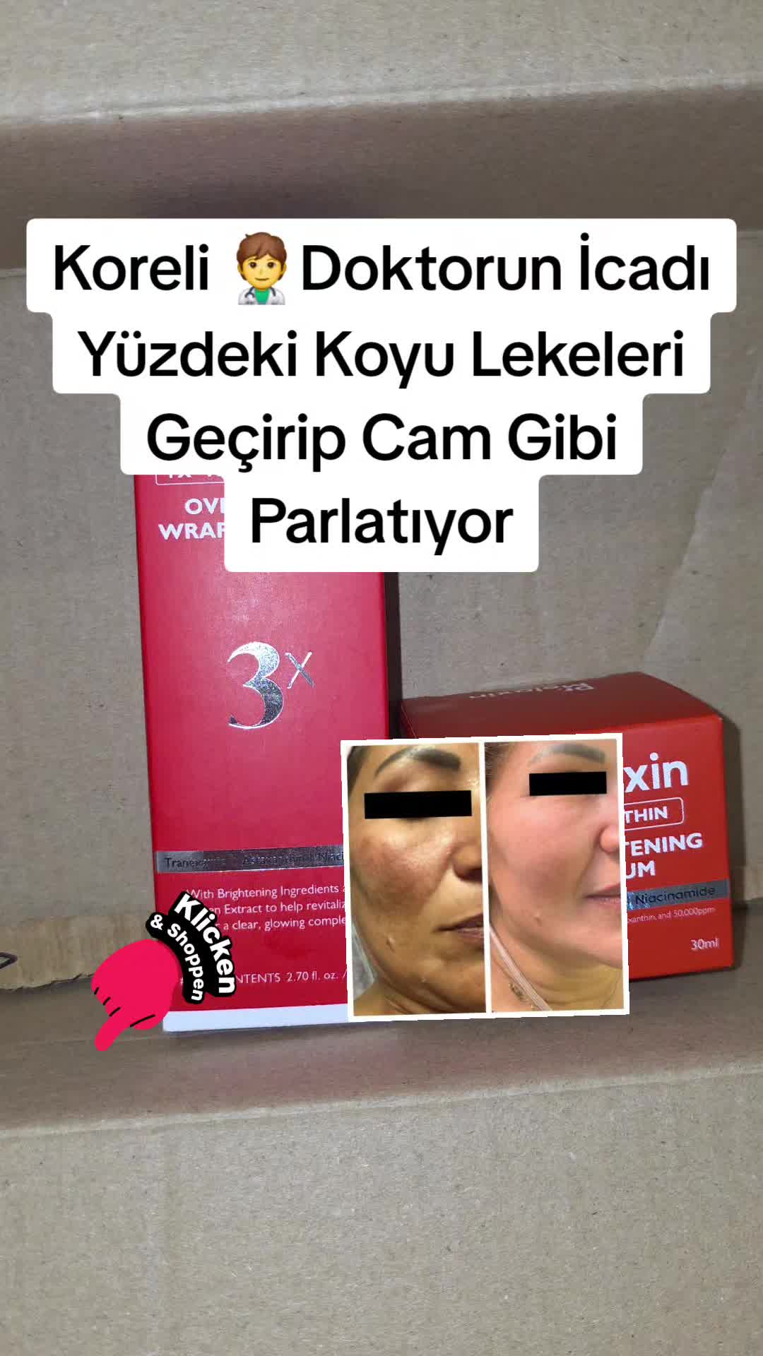 @Gurbetana27