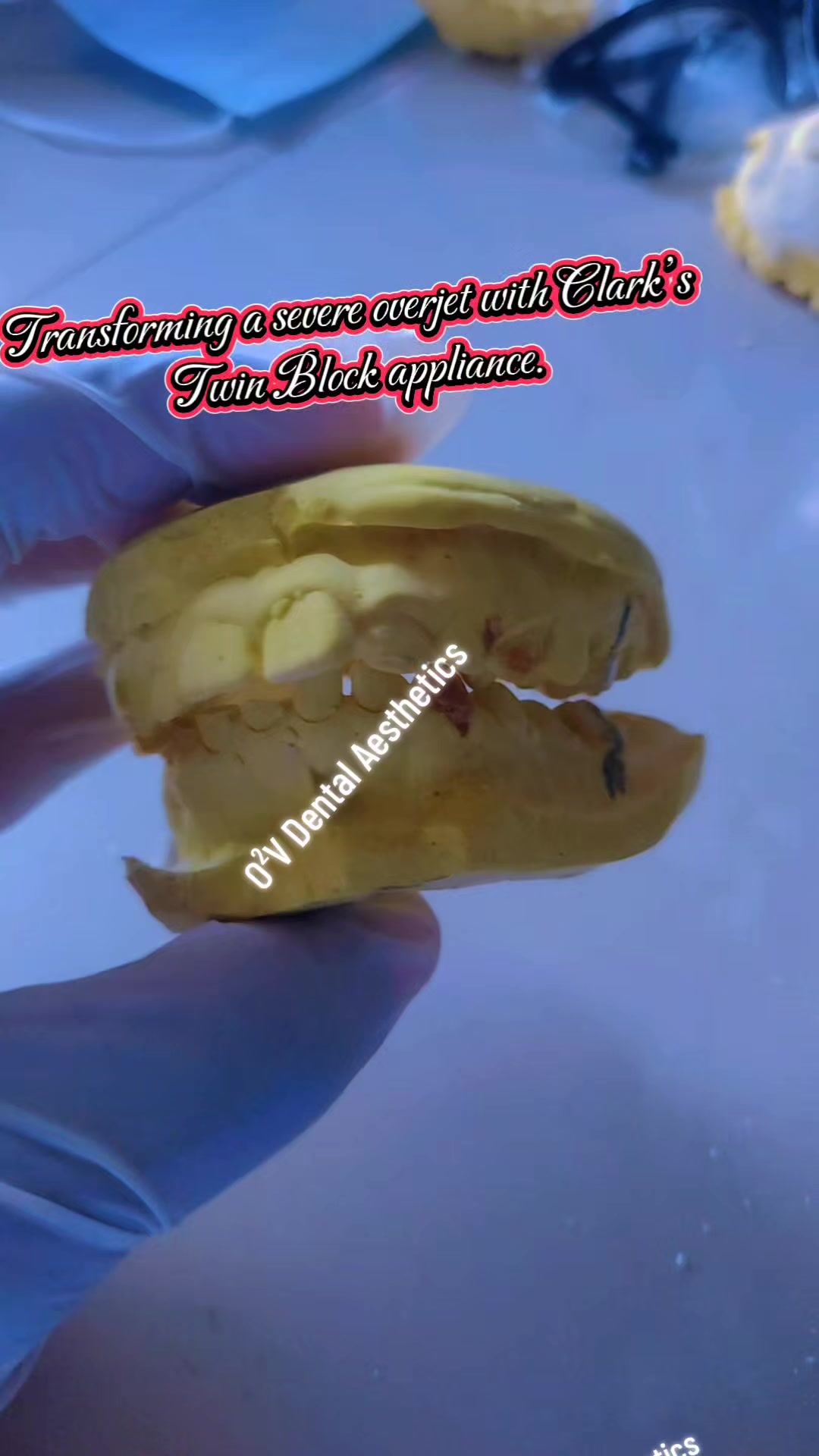 @O²V Dental Aesthetics Hub🦷
