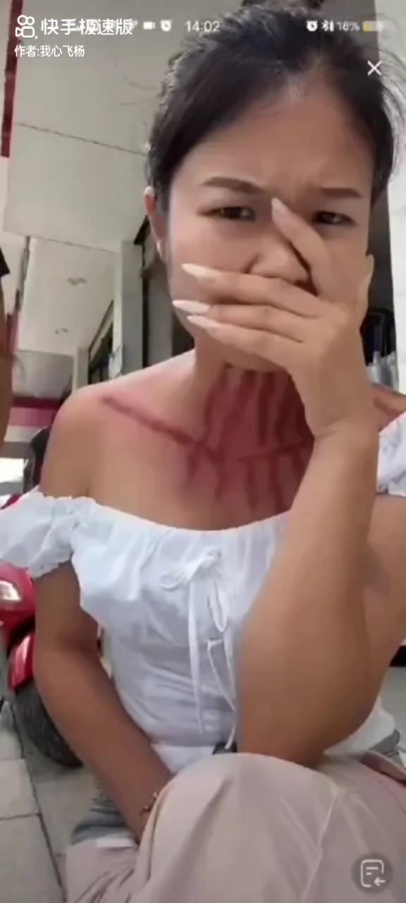 @thích cạo gió