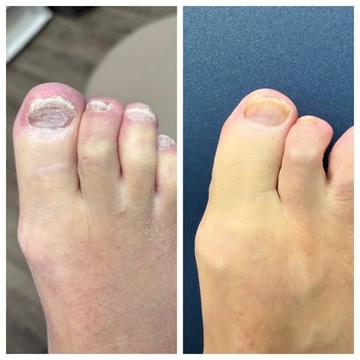 @Deniel Foot and Ankle Center