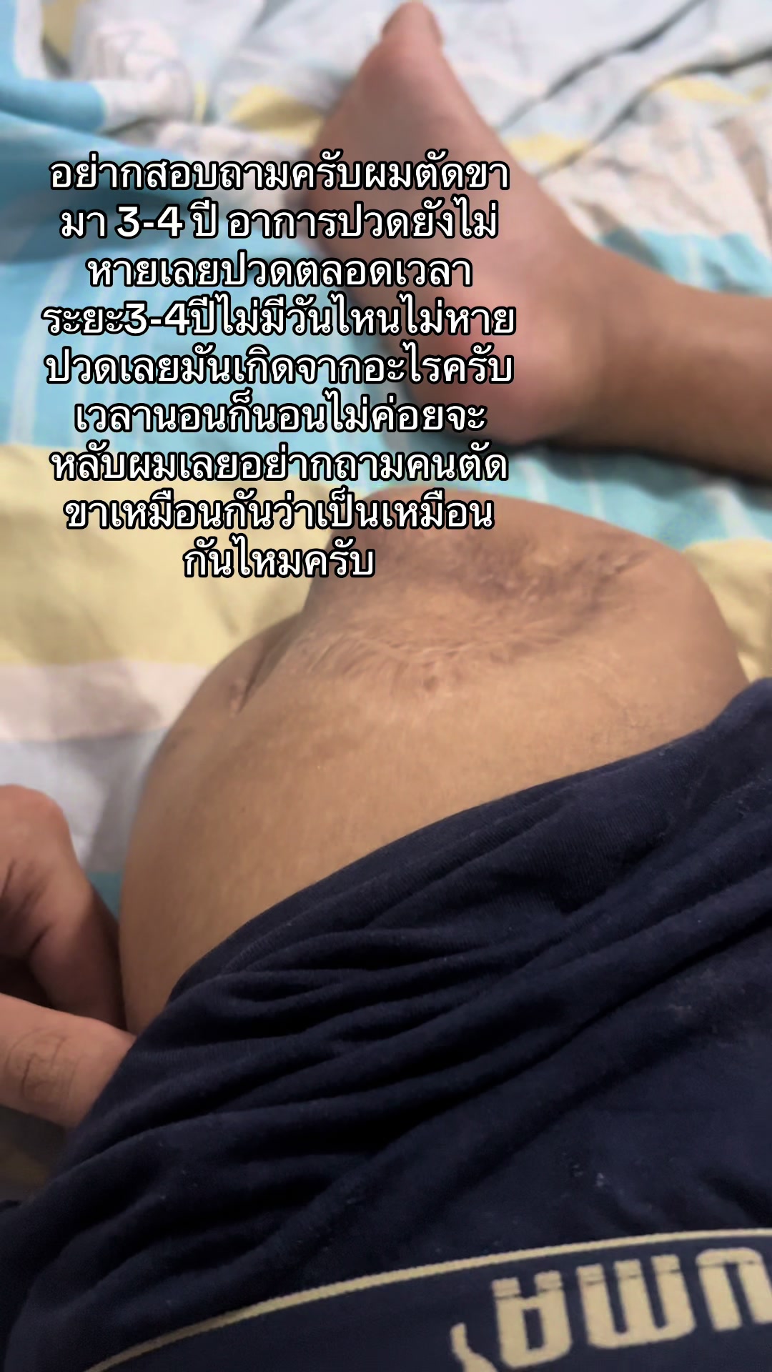 @Yotsapol❤️👌 ( 10.5k ) ขาเหล็ก