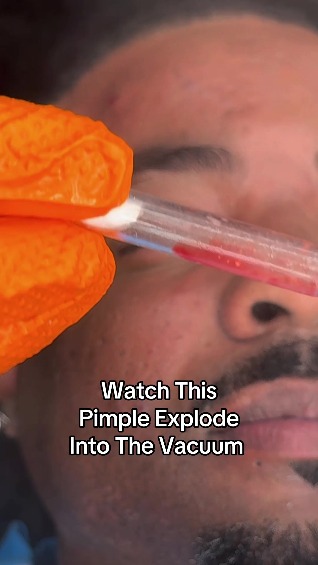 @Ronnie