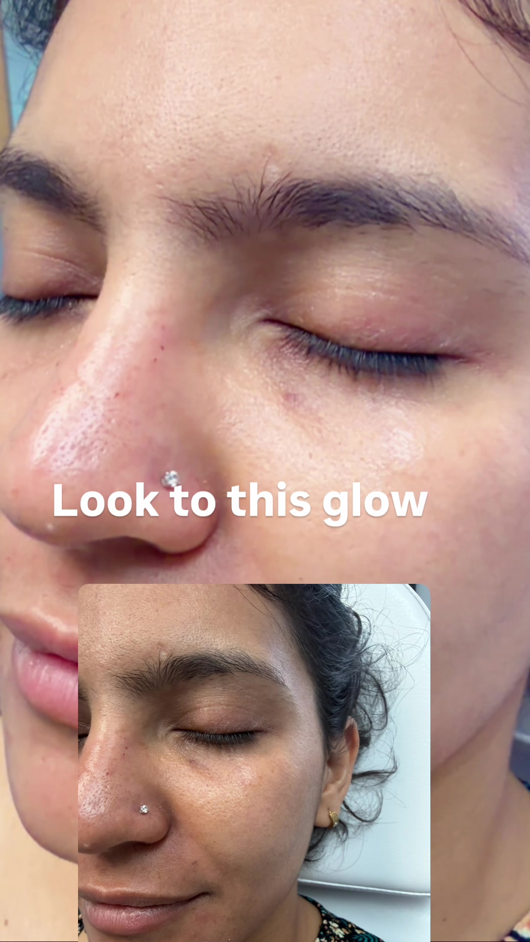 @Summer Skin Clinic | Toronto