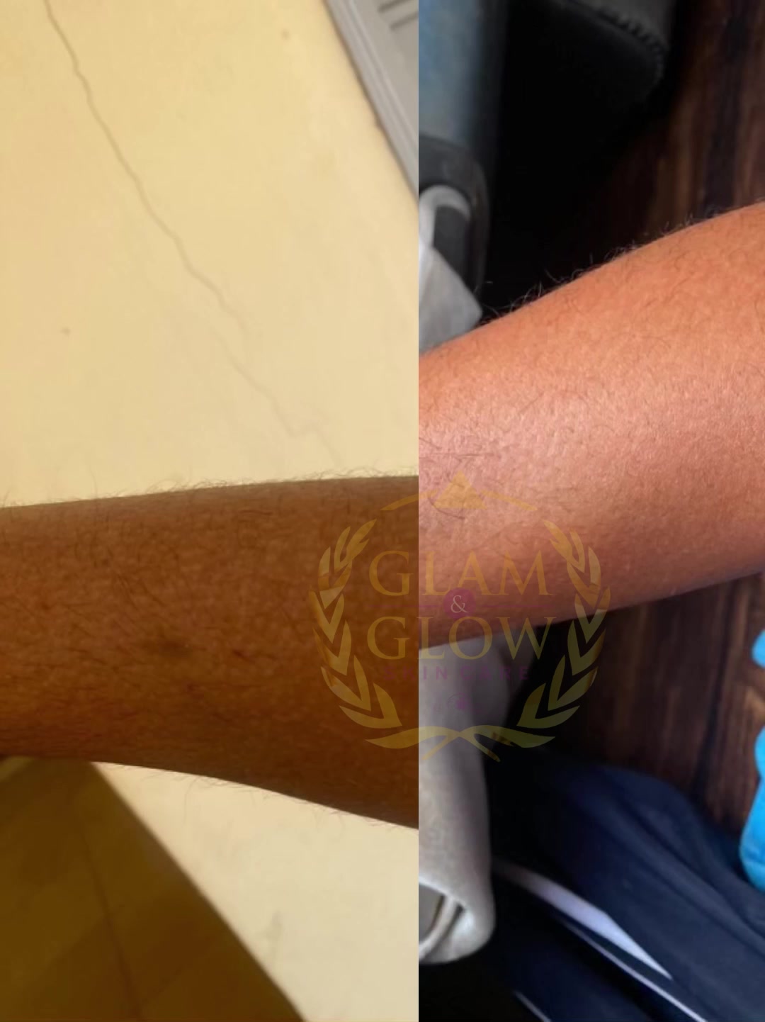 @SKIN REPAIR TREATMENT EXPERT