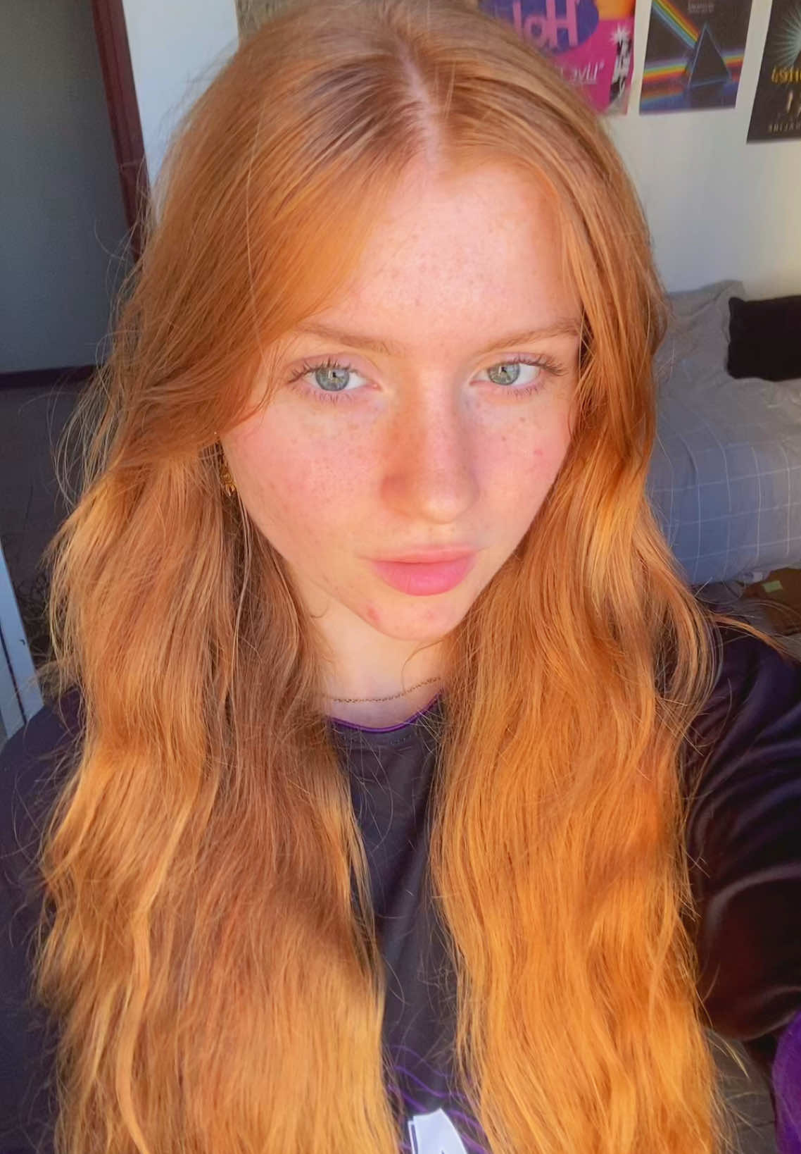 @lorg315
