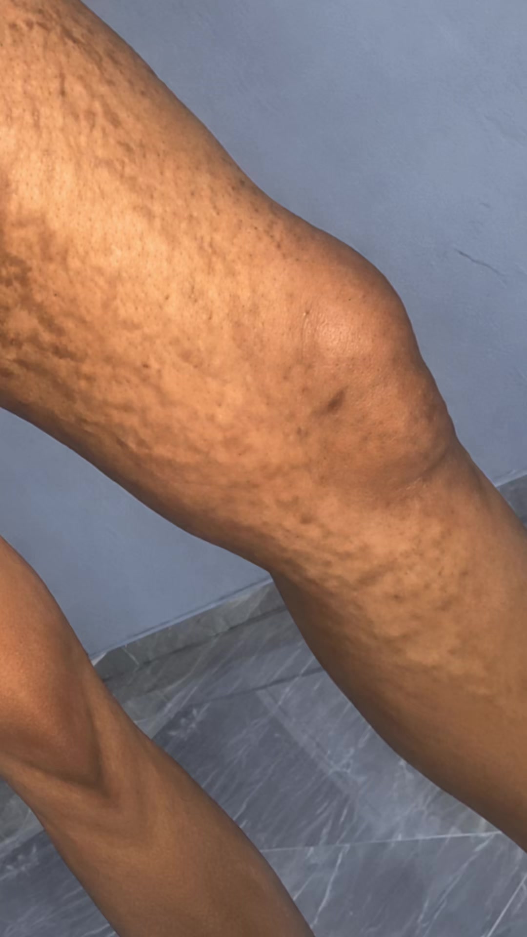 @Radiant skin