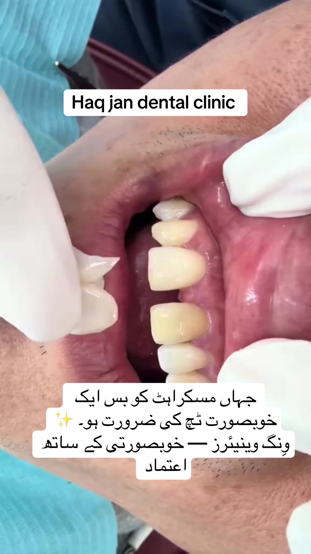 @Dr_Haq_jan_official