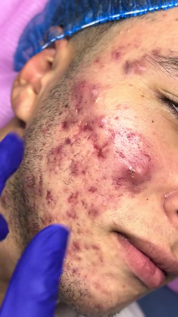 @menna_skintherapist