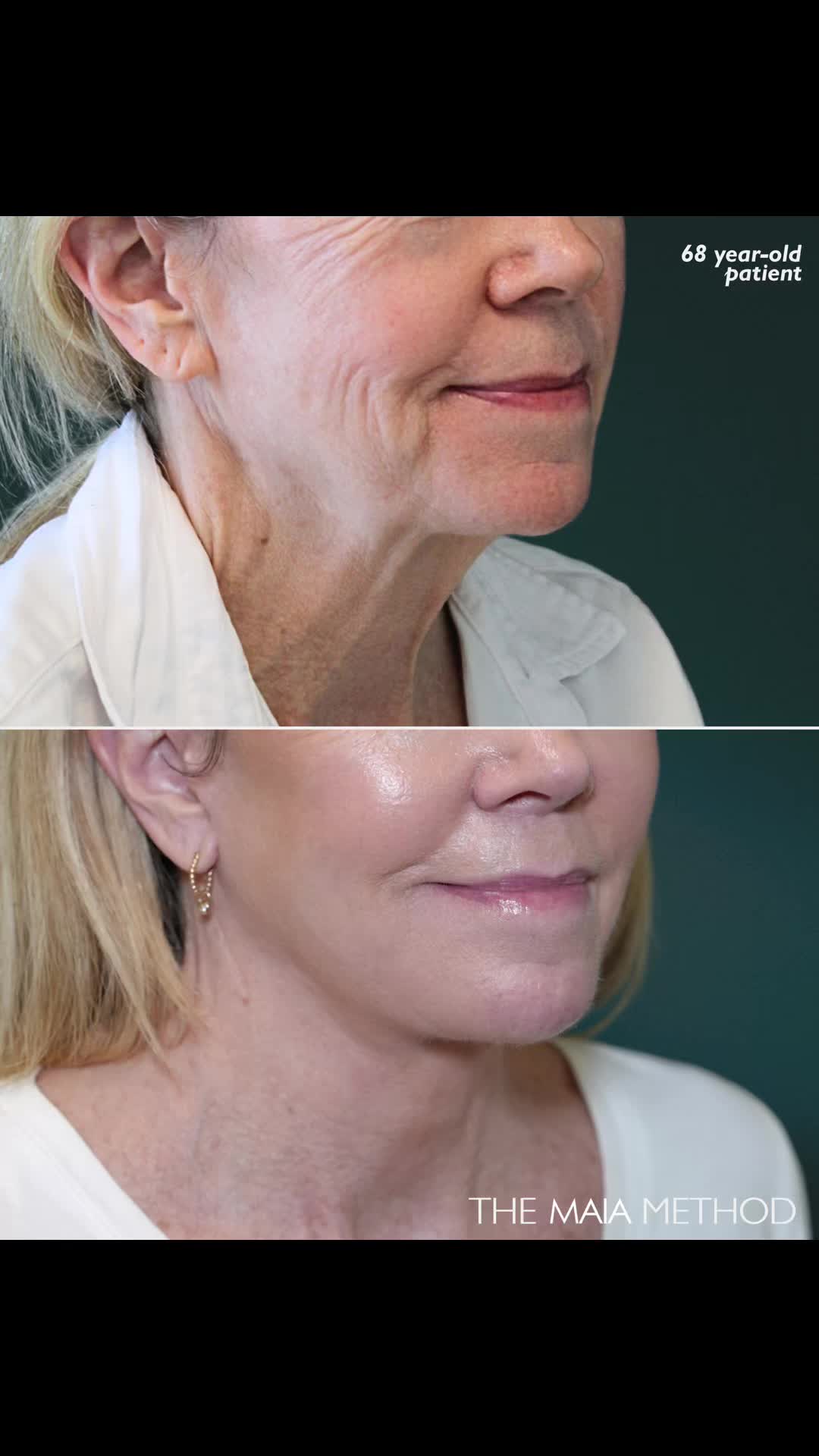 @Dr. Maia | Plastic Surgeon