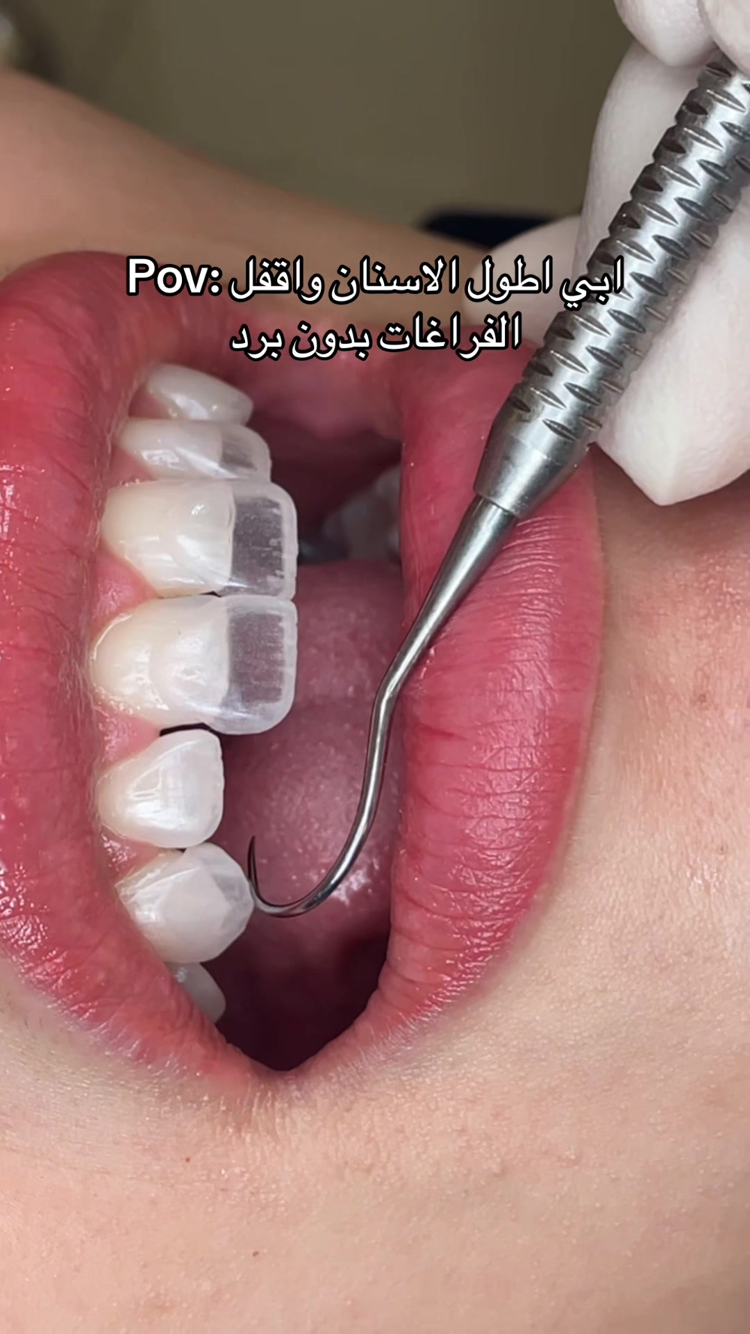 @Dr. Abrar Alhababi