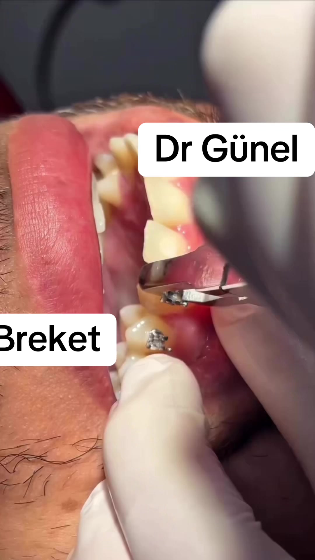 @Dentist_G&uuml;nel