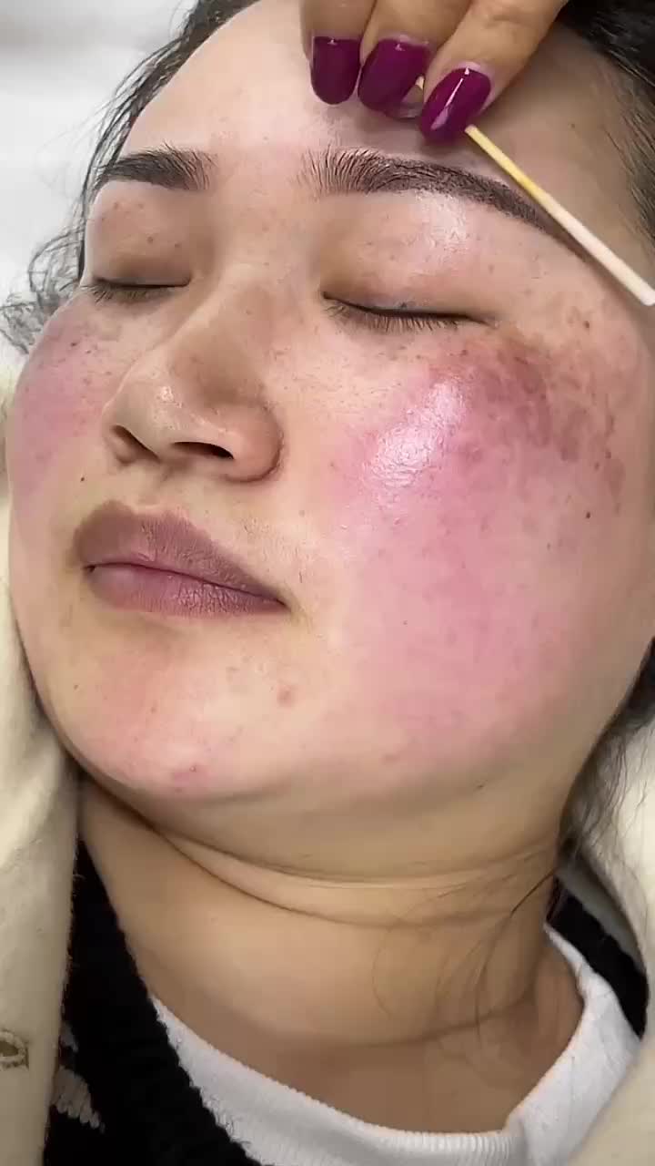 @Skincare Queen👑