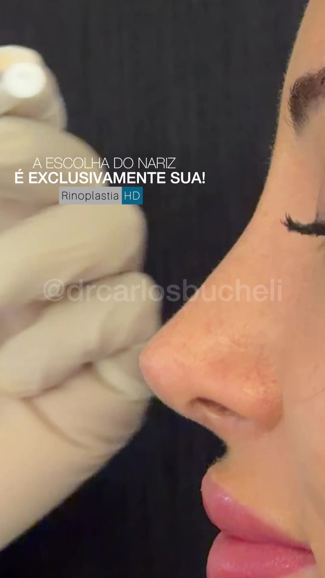 @Dr. Carlos Bucheli