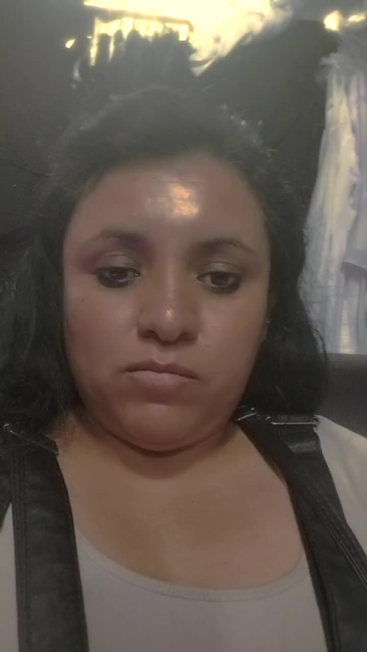 @Paty Patito Patita rota 🦴🦵🩼