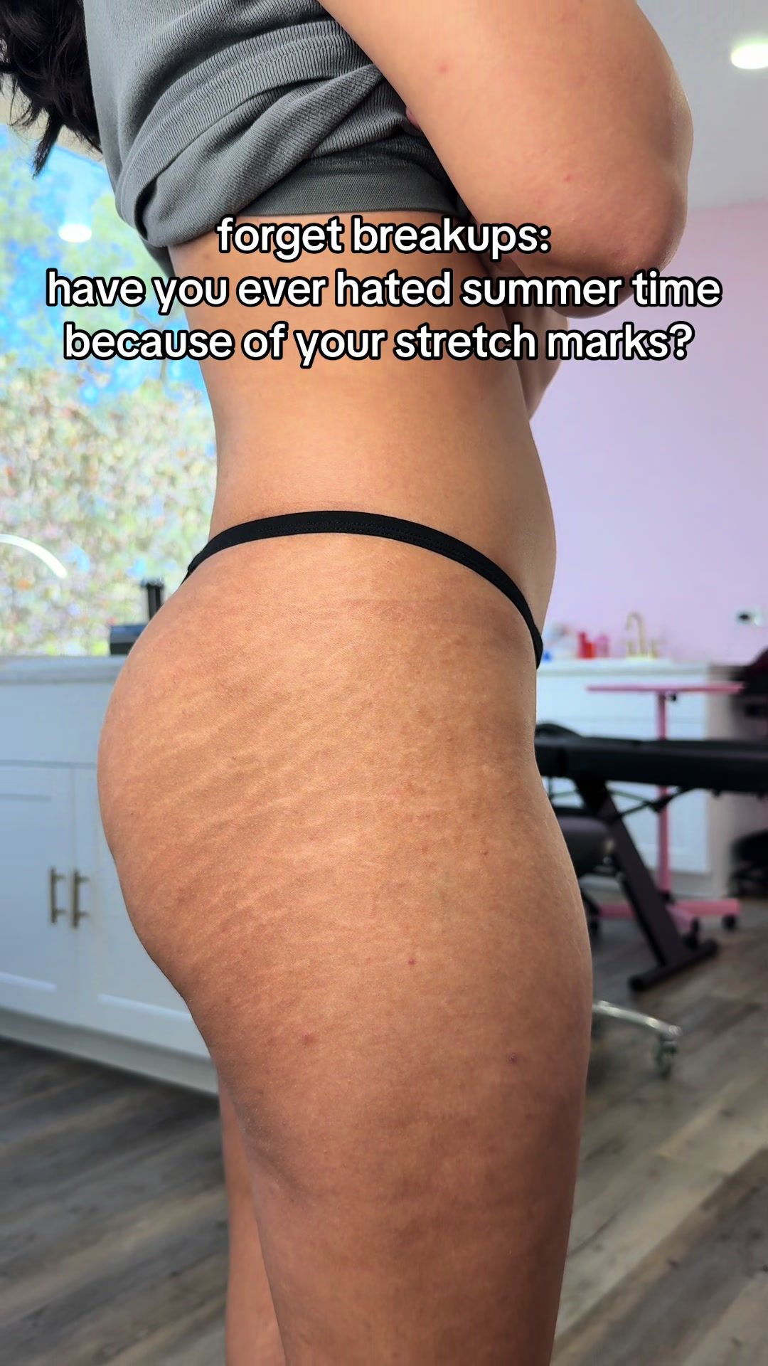 @Stretch Mark Fairy 🧚✨
