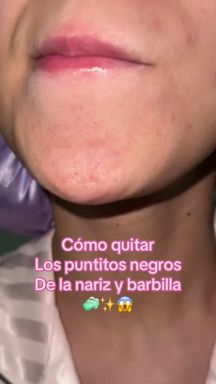 @lim_klimali