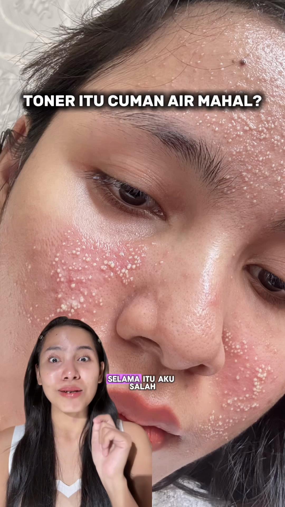 @Deenish_
