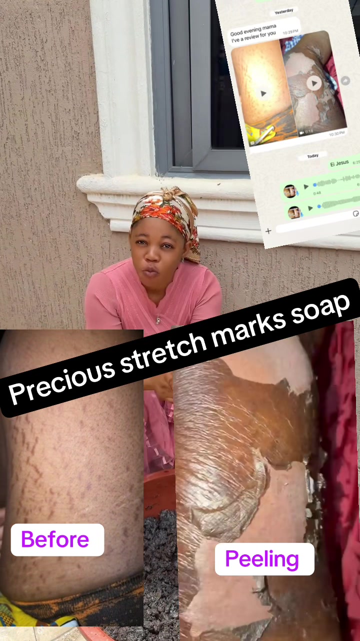 @@ Precious peeling soap