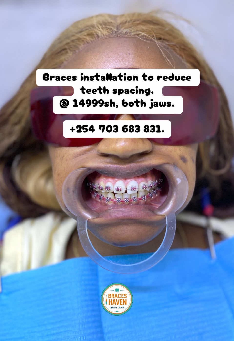 @Braces Haven Nairobi Dental