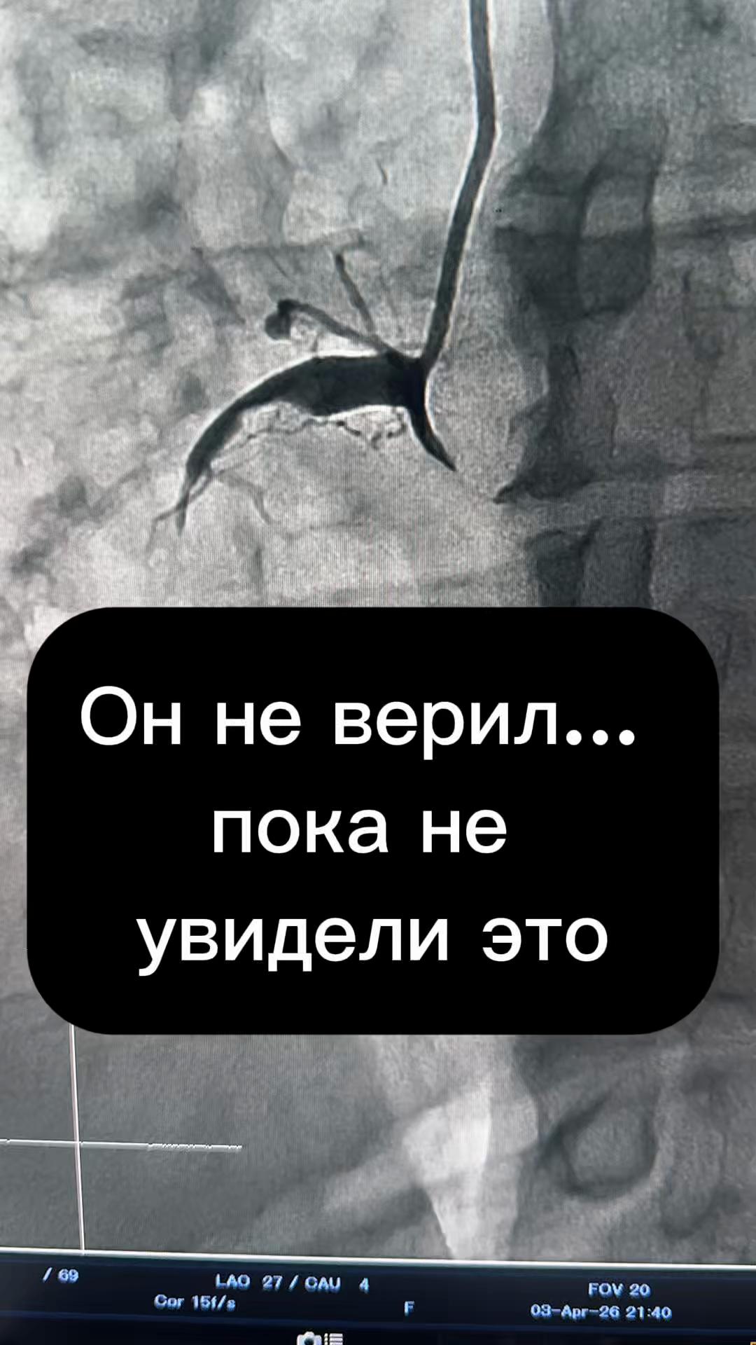 @Кардиолог / Аспет