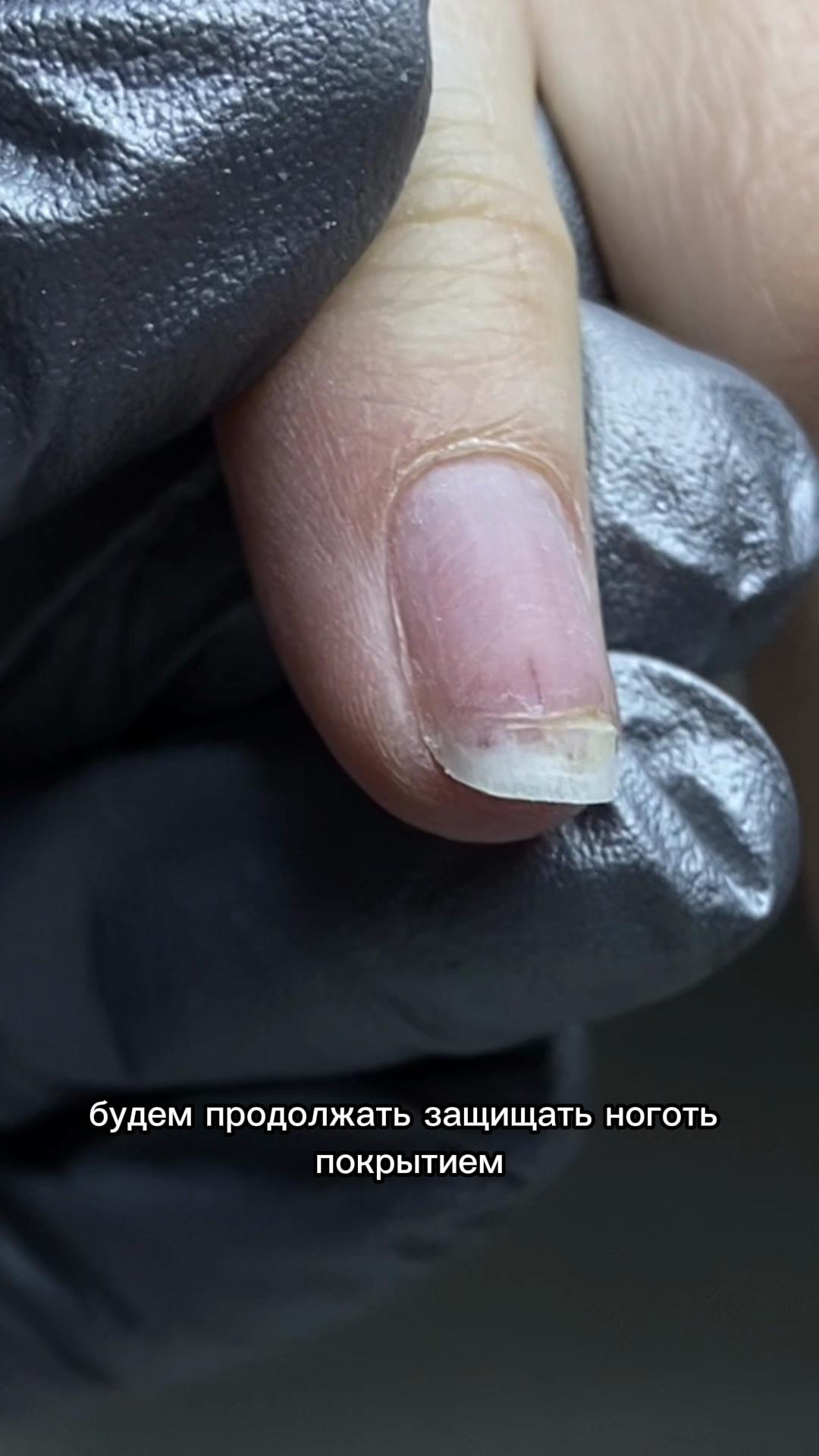 @nailssev51