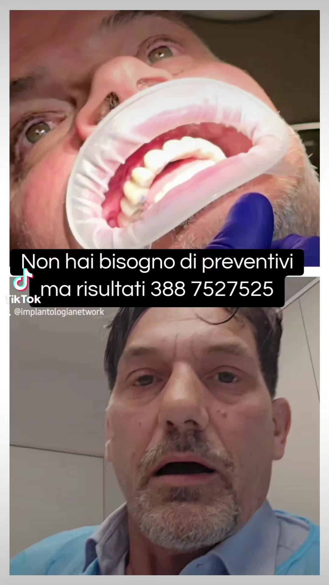 @Implantologiaprezzi