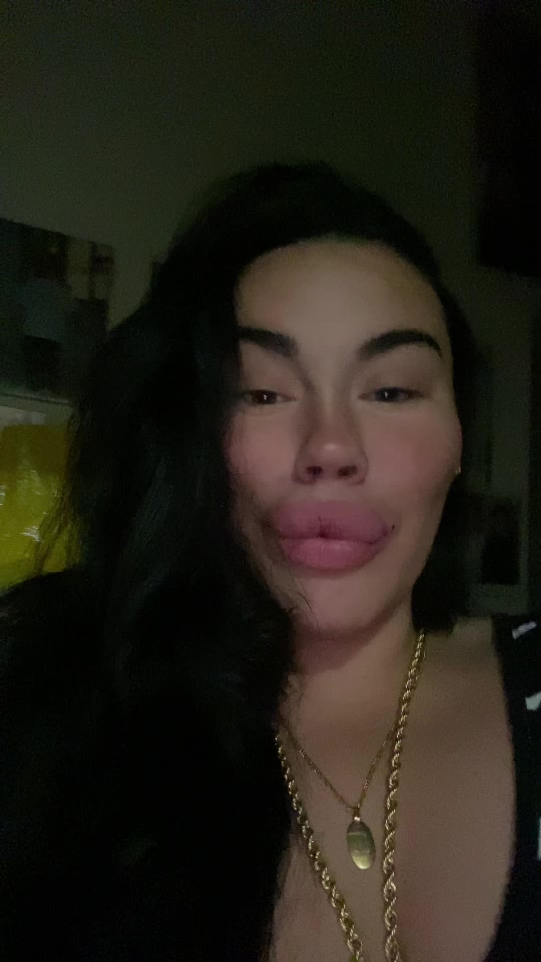 @Alessia albino