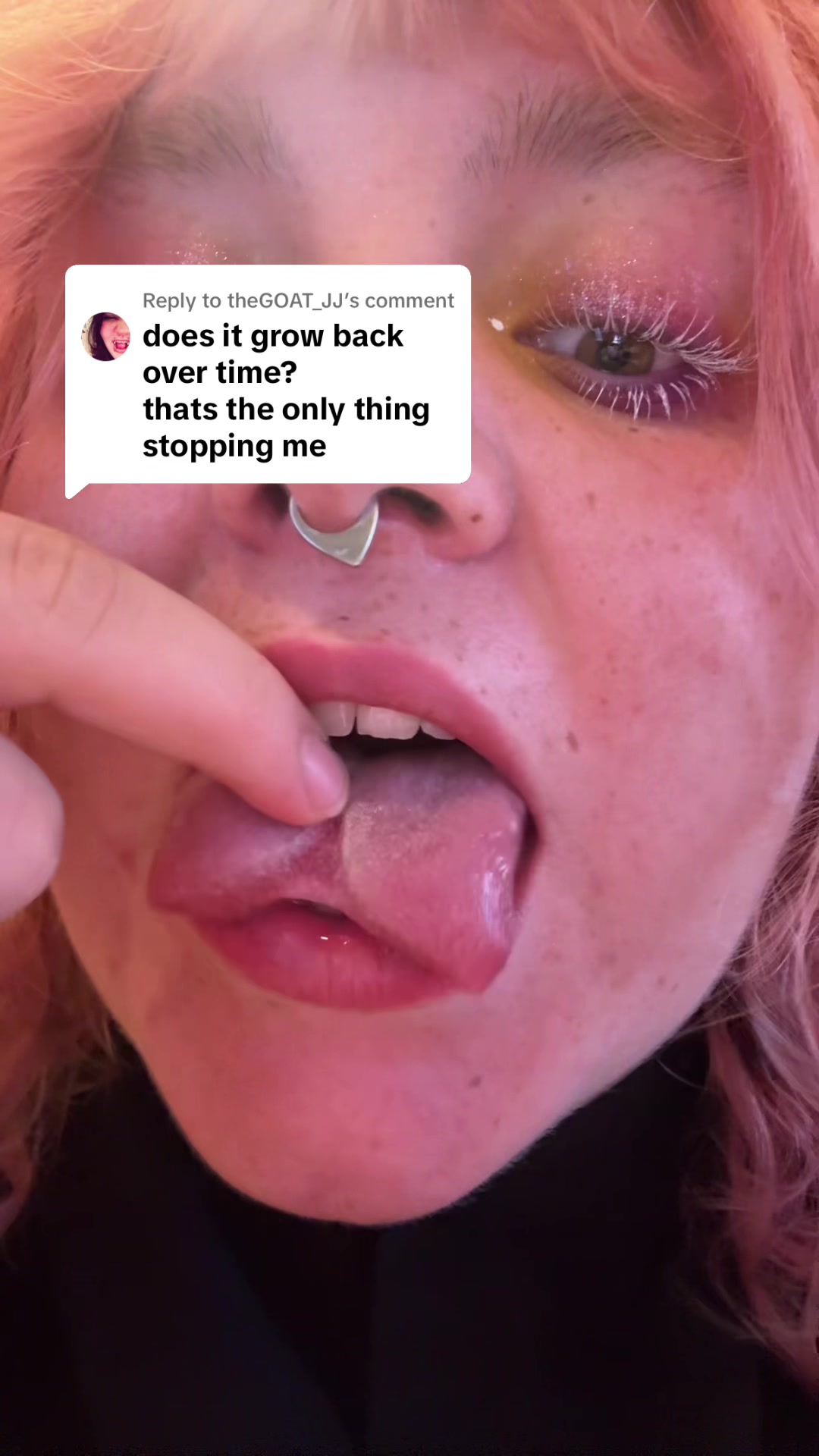 @V 777