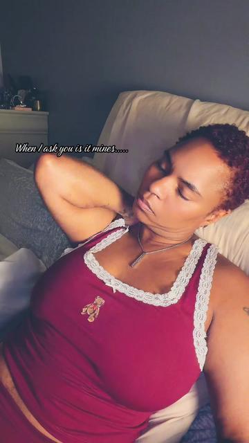 @Baldbeauty39