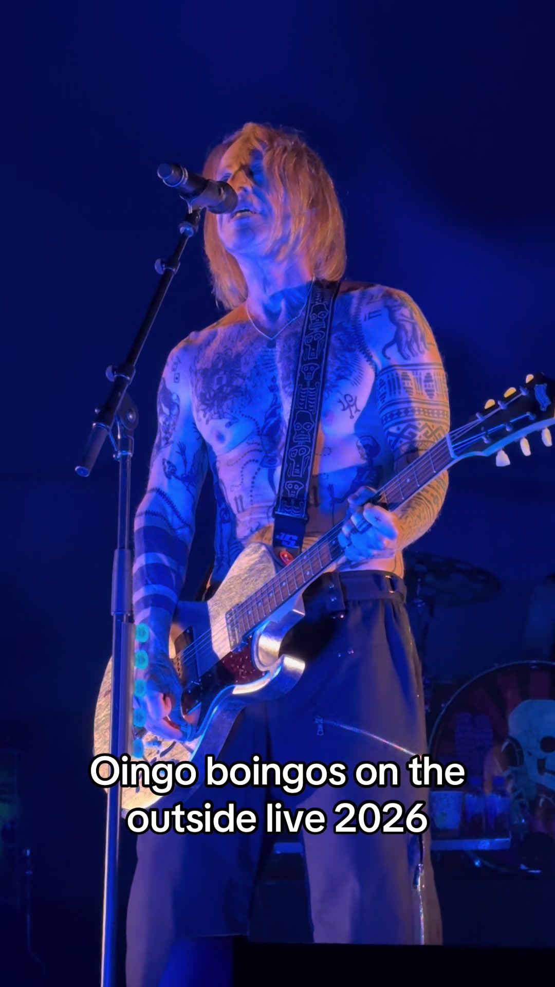 @I LOVE TWIGGY RAMIREZ