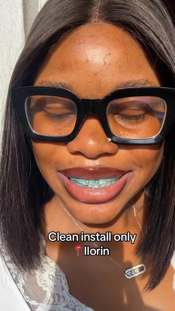 @Braces.bymavi|Smile Aesthetics
