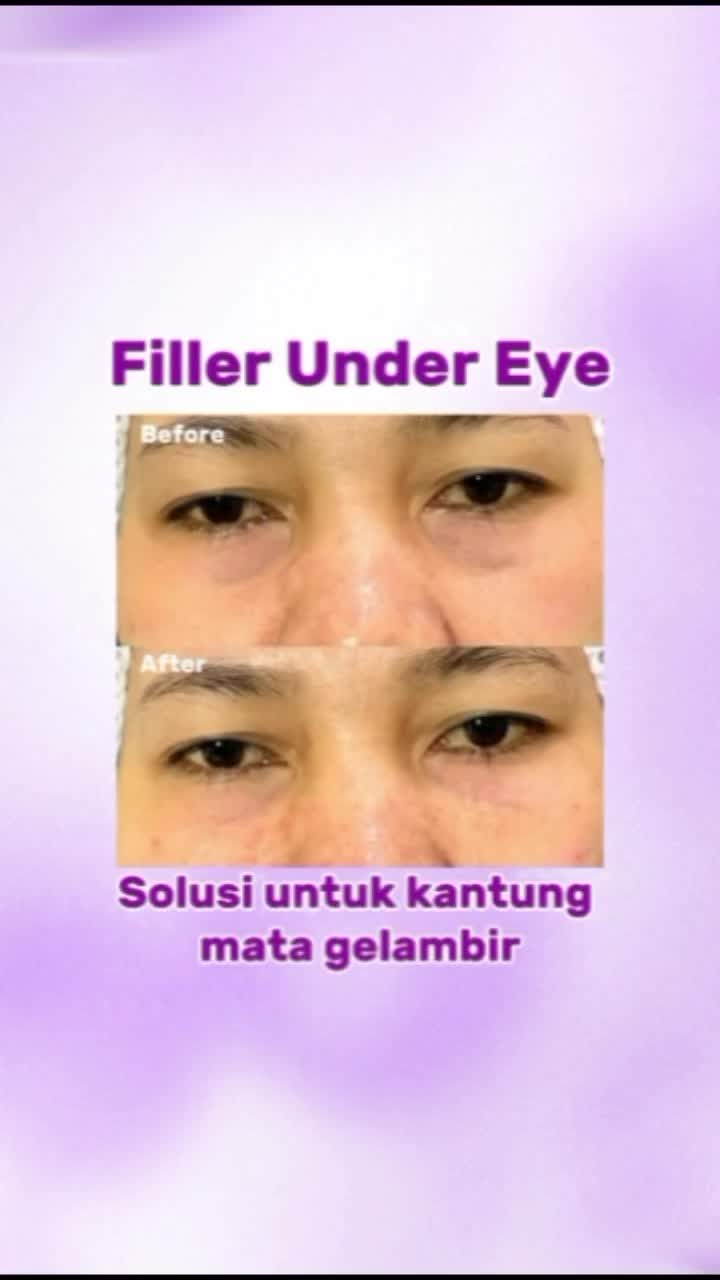 @Leny Skincare Karawaci