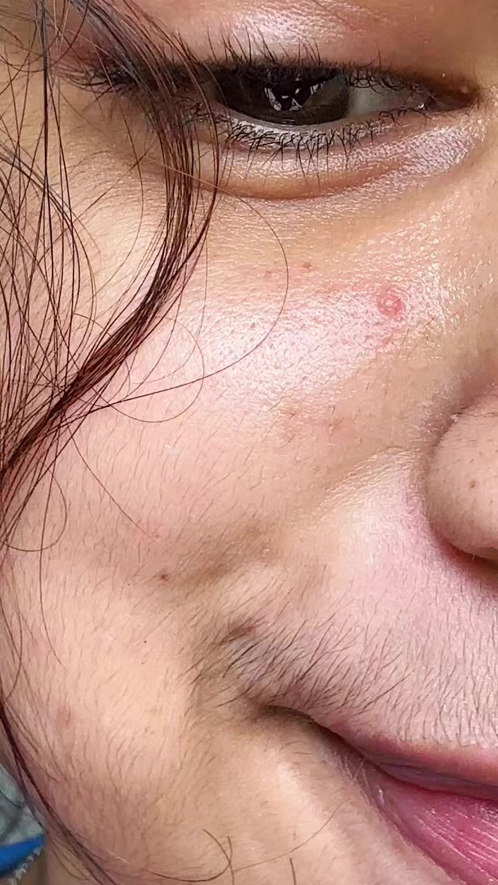 @bunny.๐