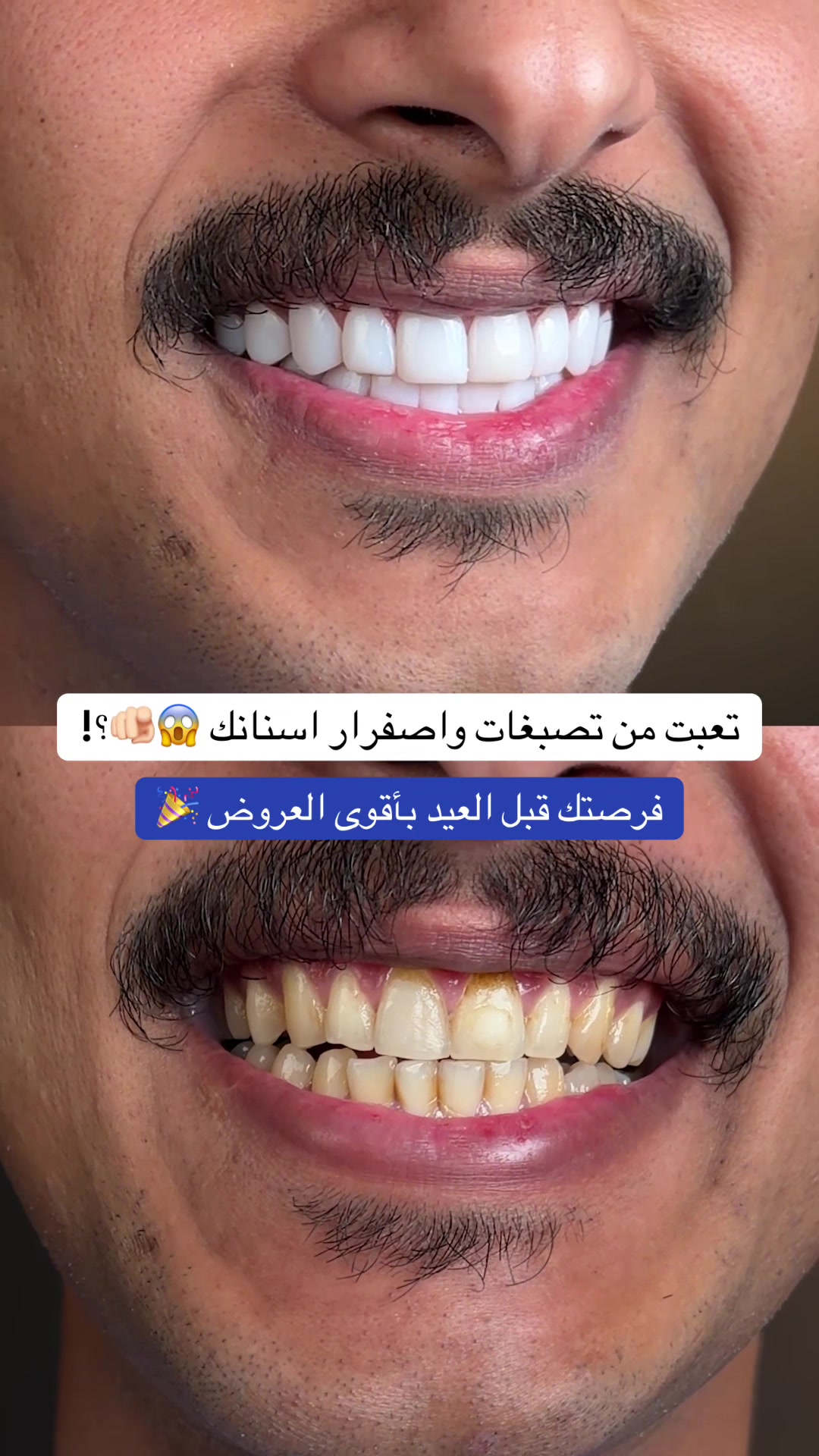 @Dr.lina_almasmoum