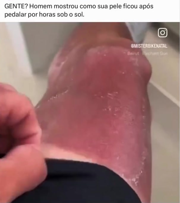 @Detalhes Da Sa&uacute;de