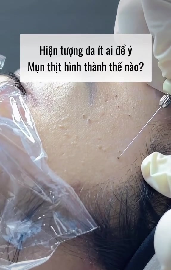 @Fb: Kim Anh Phun Xăm