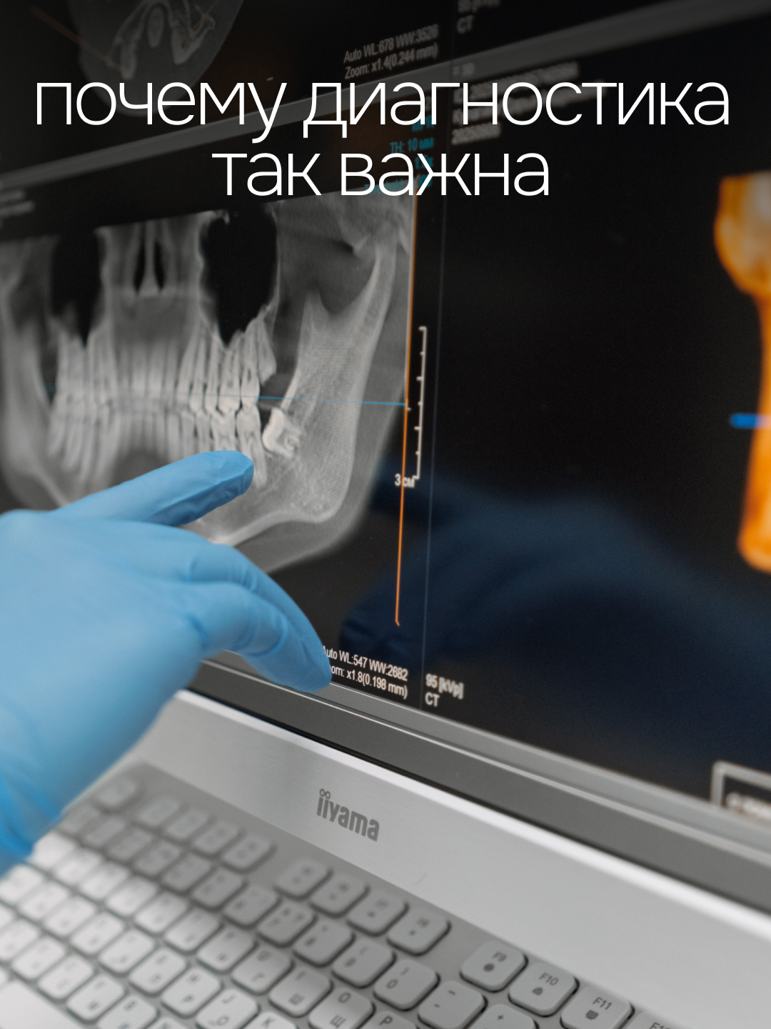 @Глеб Пекли