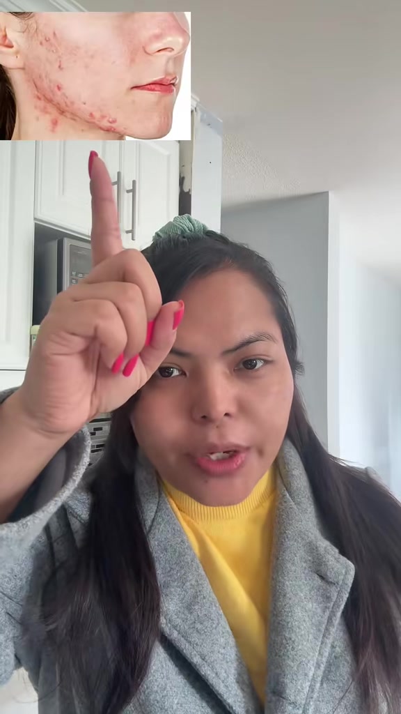 @Anita Rai