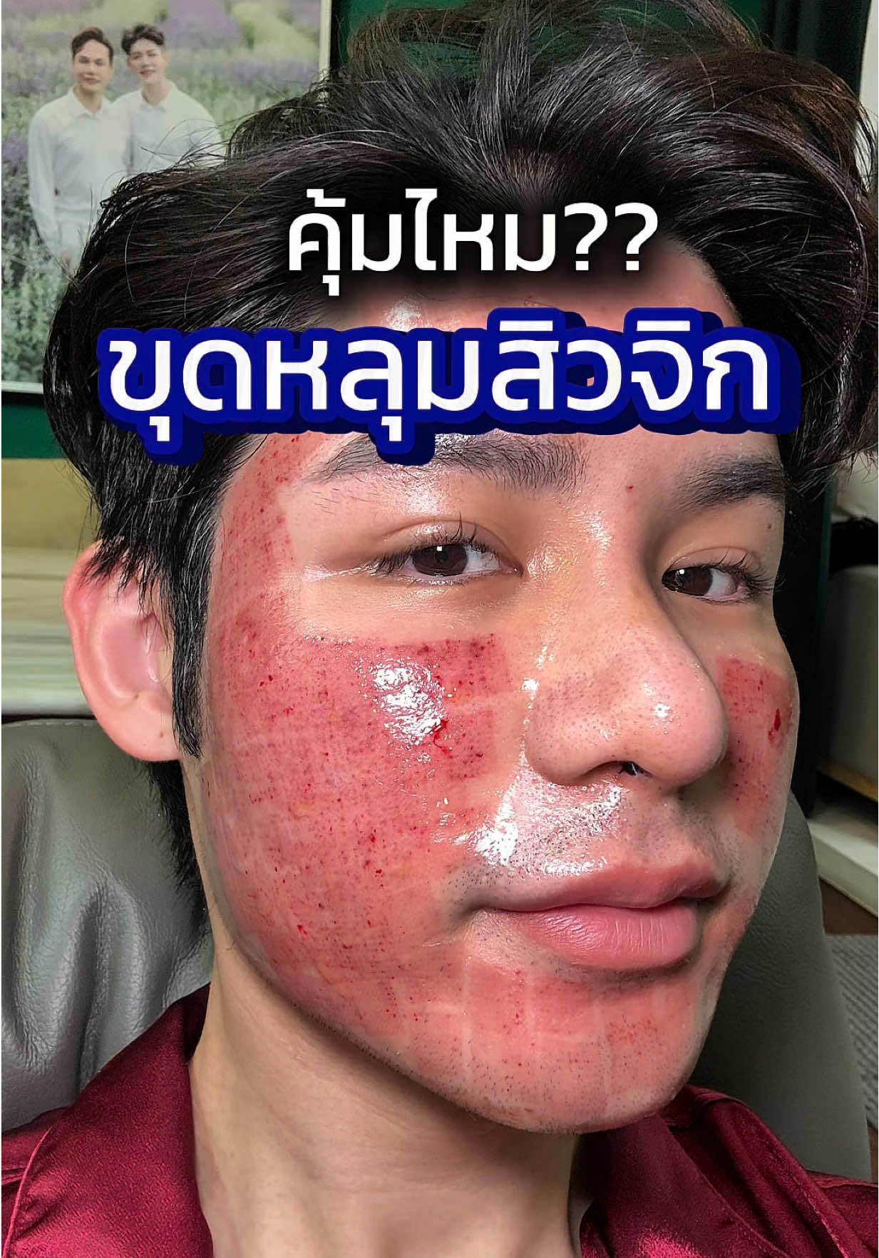 @หนูปอนด์ที่ชอบเลเซ่อร์