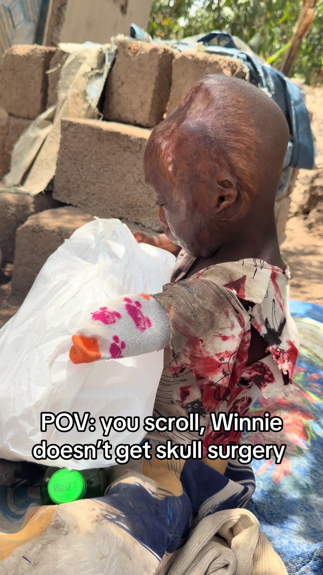 @Matayo Ssentongo