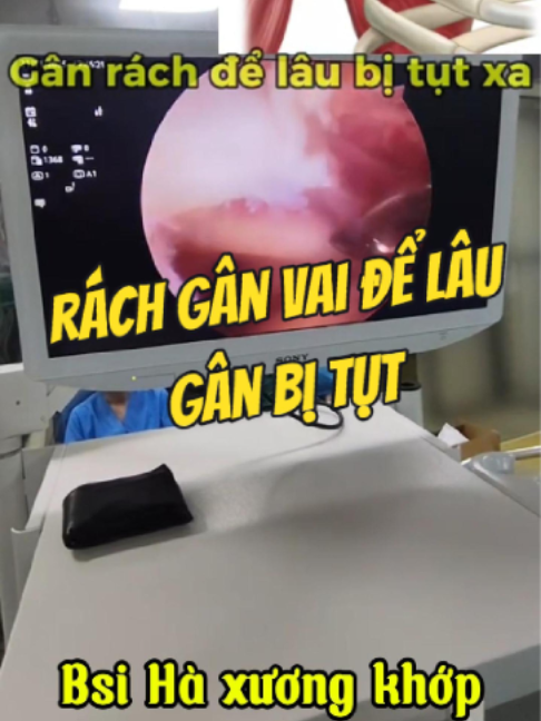 @Chuyên gia xương khớp