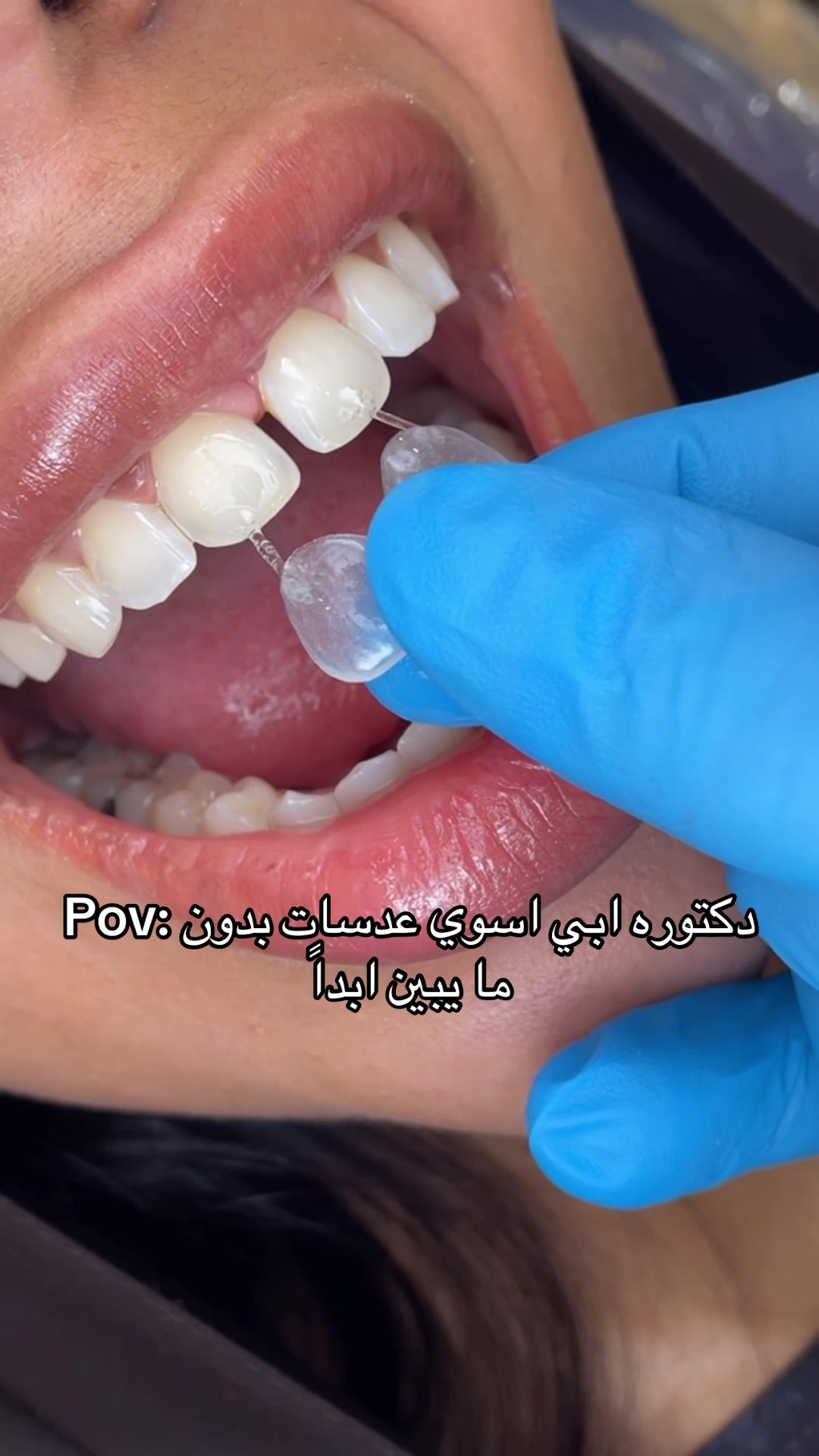 @Dr. Abrar Alhababi