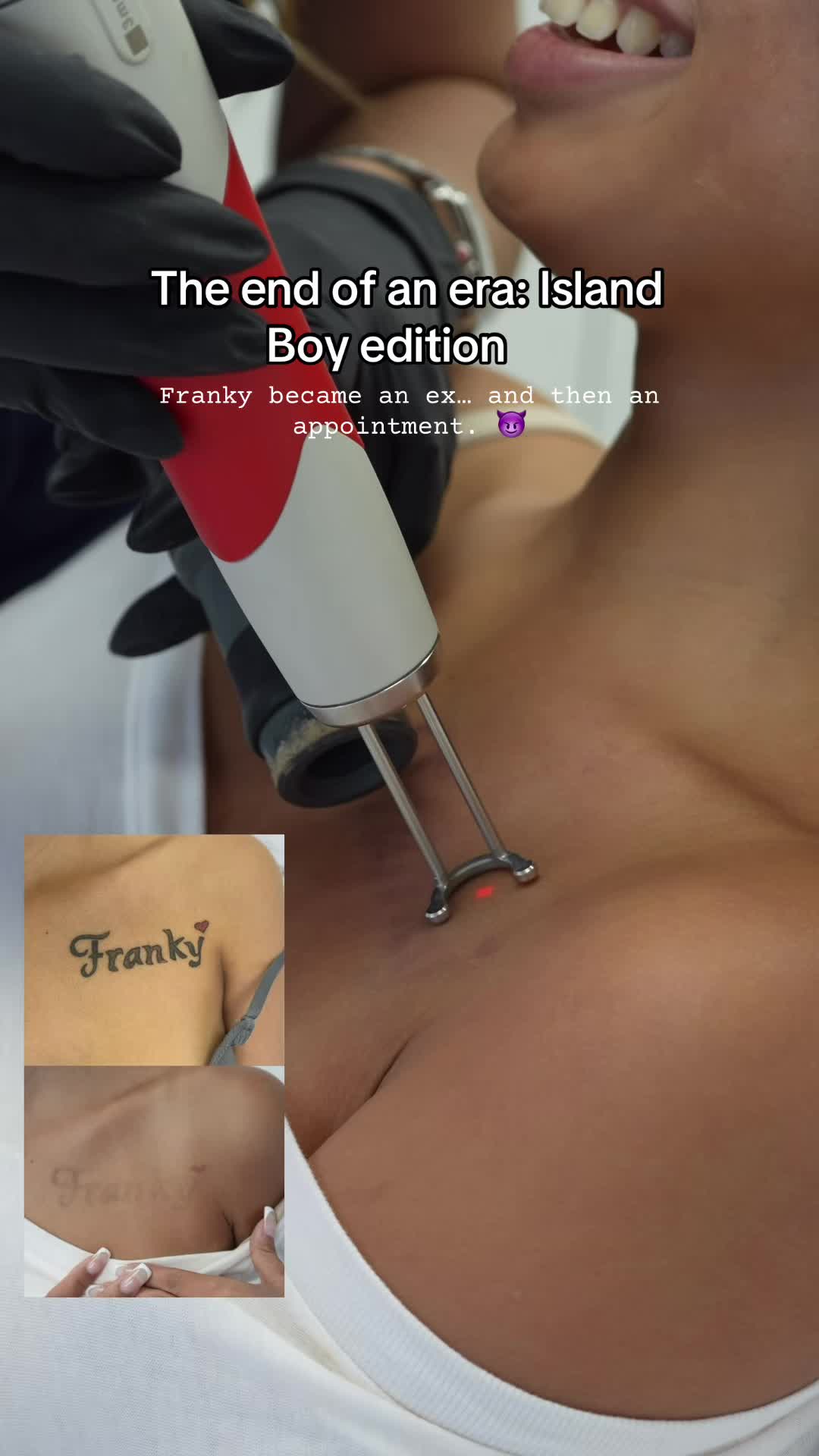 @@BHLASERTATTOOREMOVAL