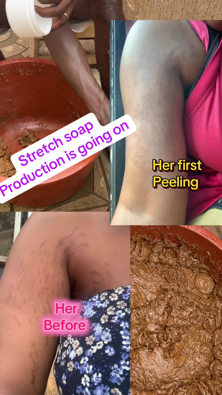 @@ Precious peeling soap