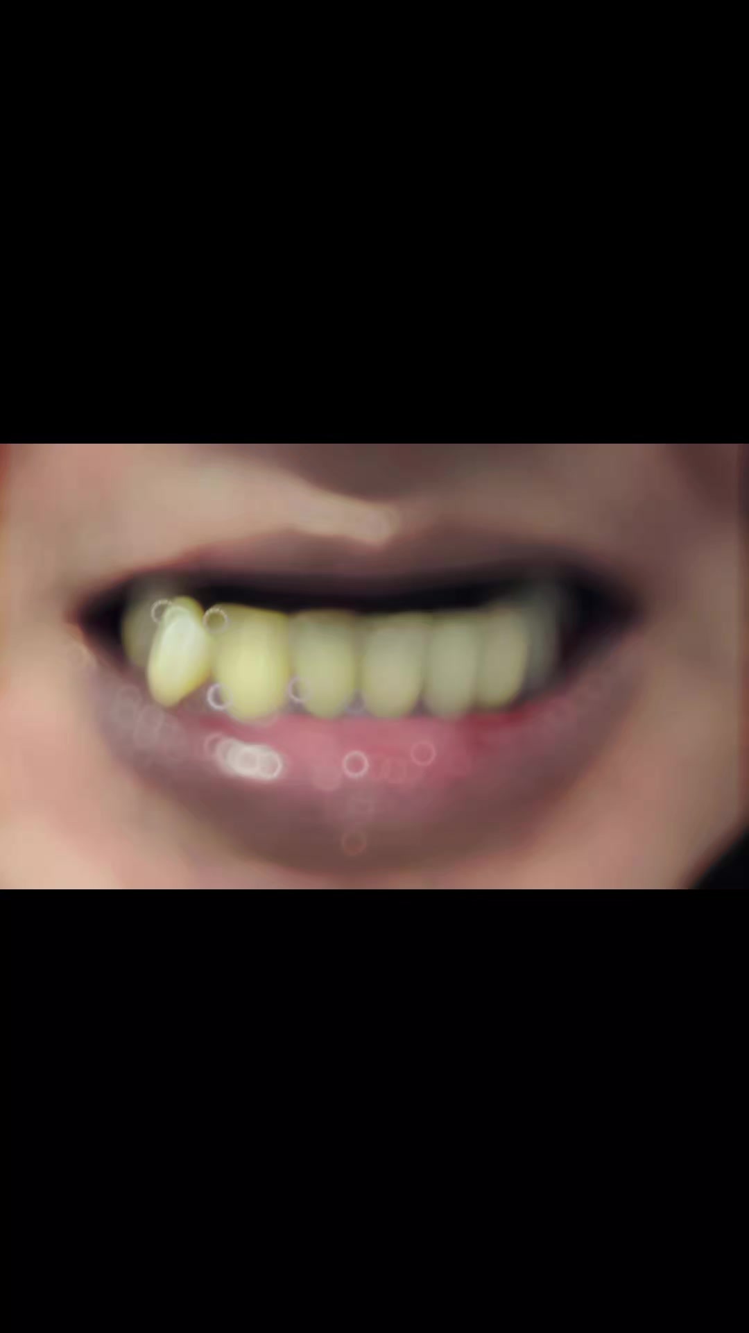 @Pearly Smile