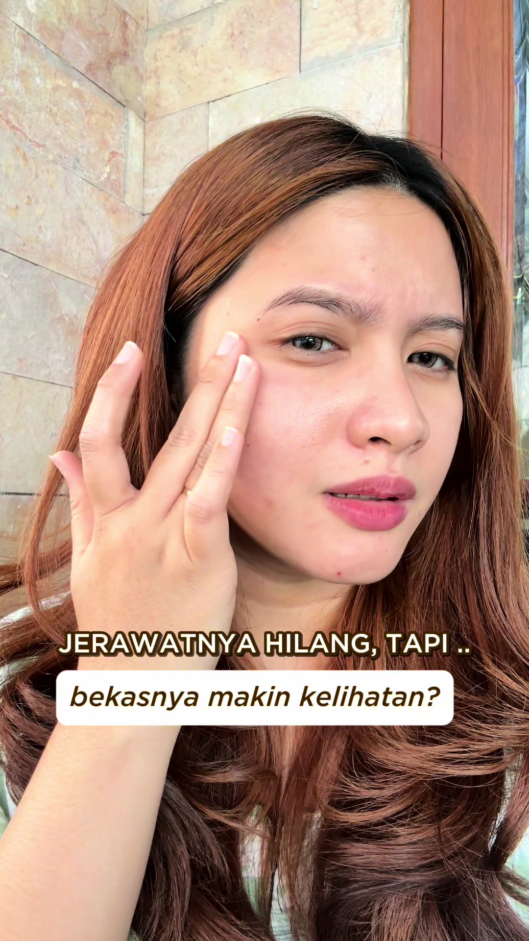 @AmuraOfficial