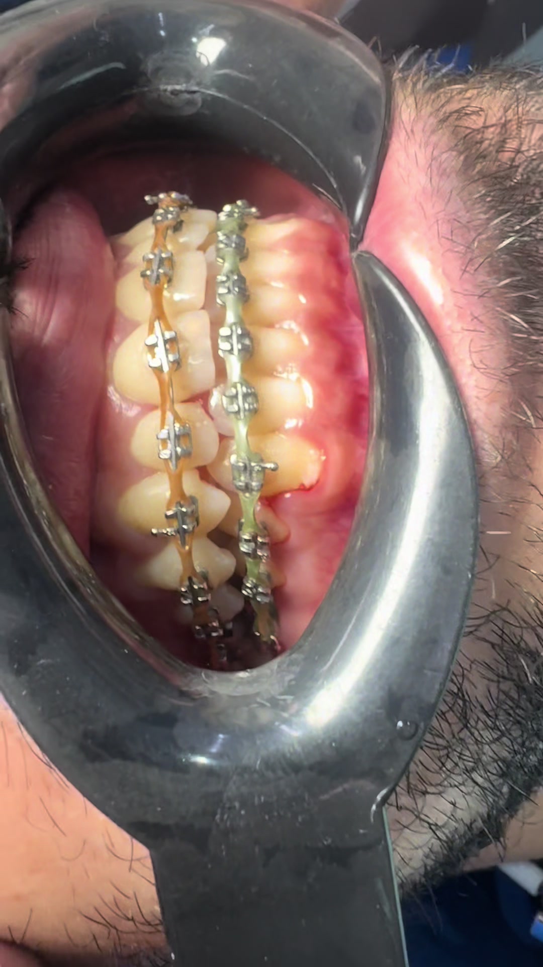 @Dr RahmatullahDental surgeon
