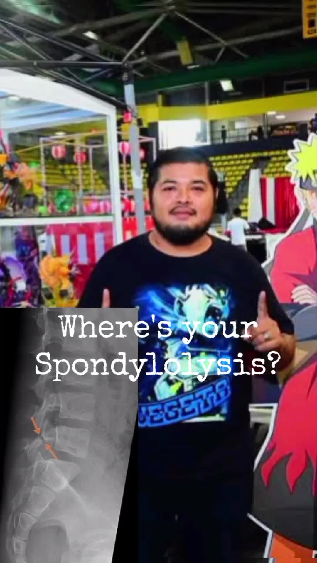 @SeñorAnime