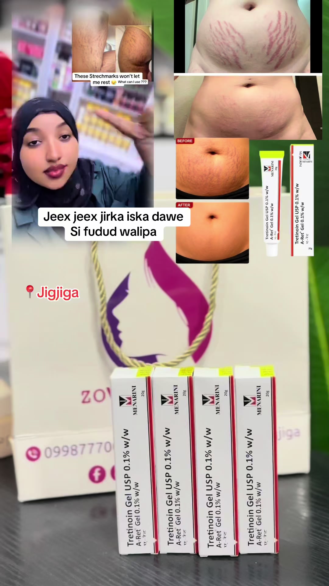 @ŽOVA ŜKIN Č̣ARE