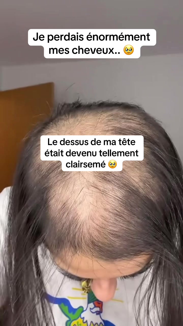 @Lux’Hair Growth